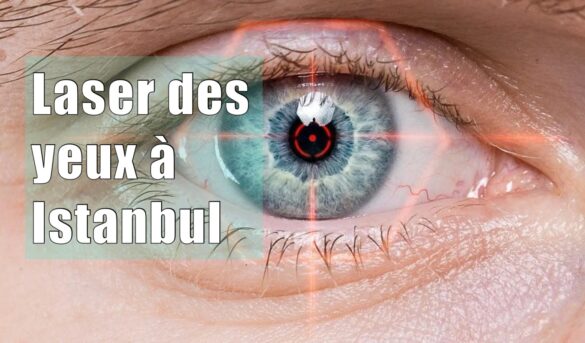 Faire Une Chirurgie Des Yeux Au Laser Istanbul Prix Proc Dure